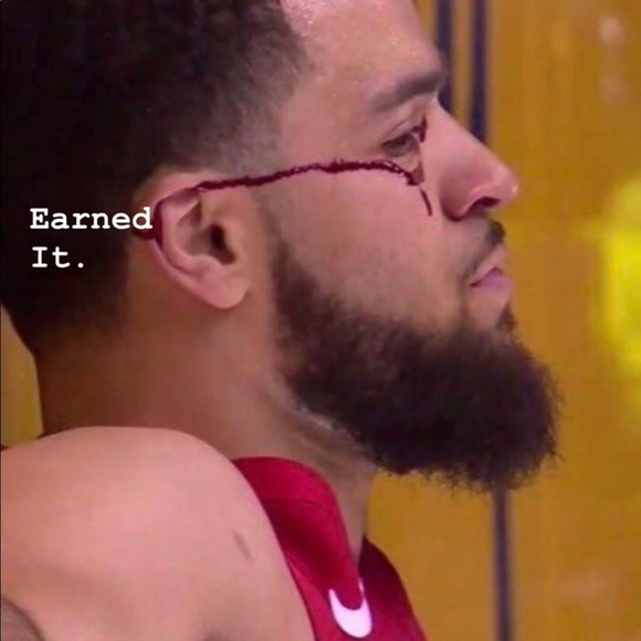 Meet your Posher, Clayton - Picture 1 of 1